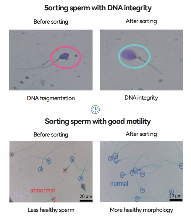 针对男性问题的先进辅助生殖技术