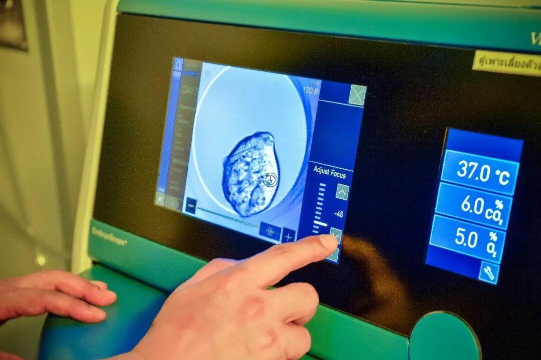 LRC配置国际高标准无尘实验室 ，提升试管成功率