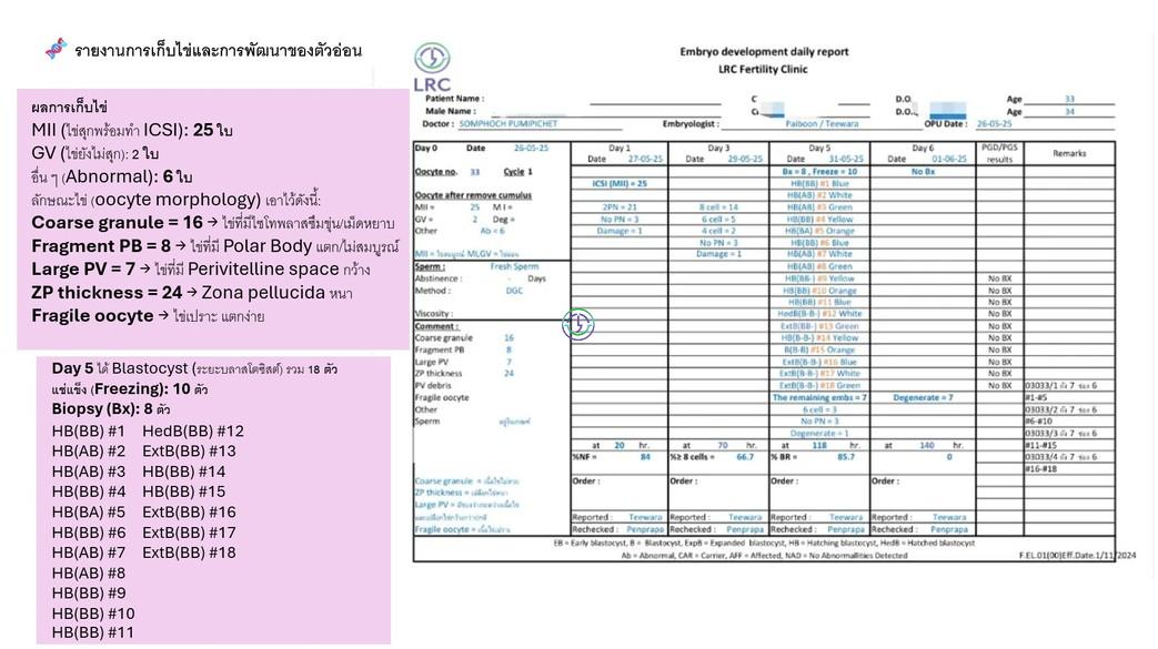 LRC助力：多囊卵巢综合征不是障碍，从不孕到三代试管婴儿的成功之路