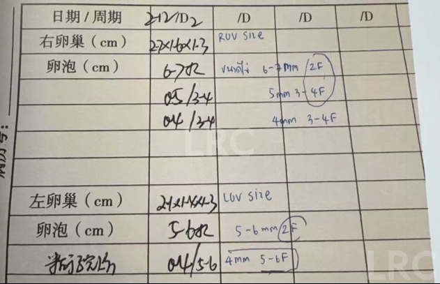 37岁卵泡不均难促排,LRC精准促排实现受精养囊双百,拿下10颗囊胚!