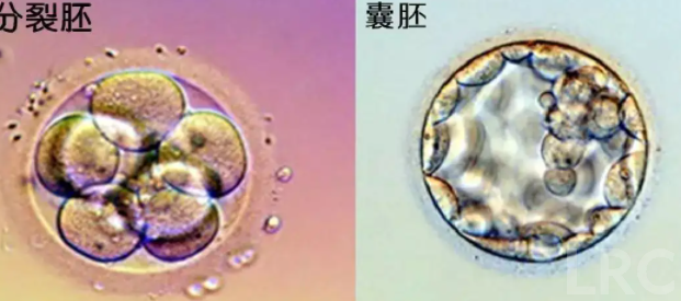 泰国冻卵保存一年具体费用是多少?