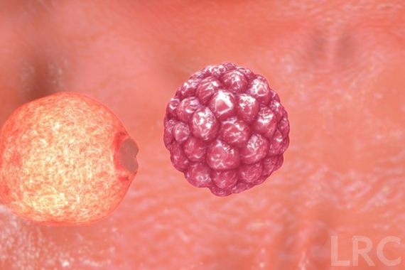 2026瞒过LRC医院冻卵费用明细大揭秘，含流程及项目费用预估！