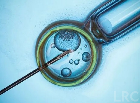 泰国冻卵医疗费用具体包含哪些项目？