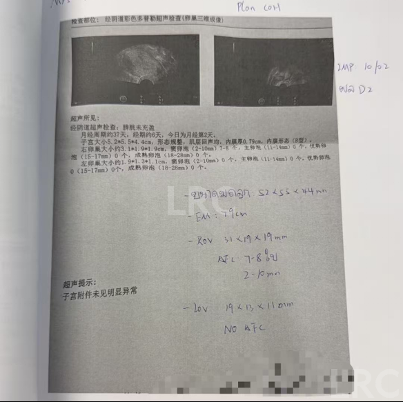 40岁卵泡不均+47岁精子双低!LRC用个性化促排盘活稀缺卵泡,4颗胚胎全成囊!