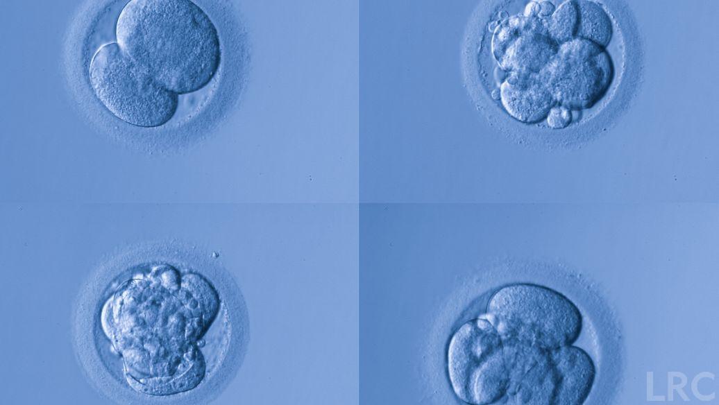 单身女性冻卵有什么风险?目前开放单身冻卵的国家盘点