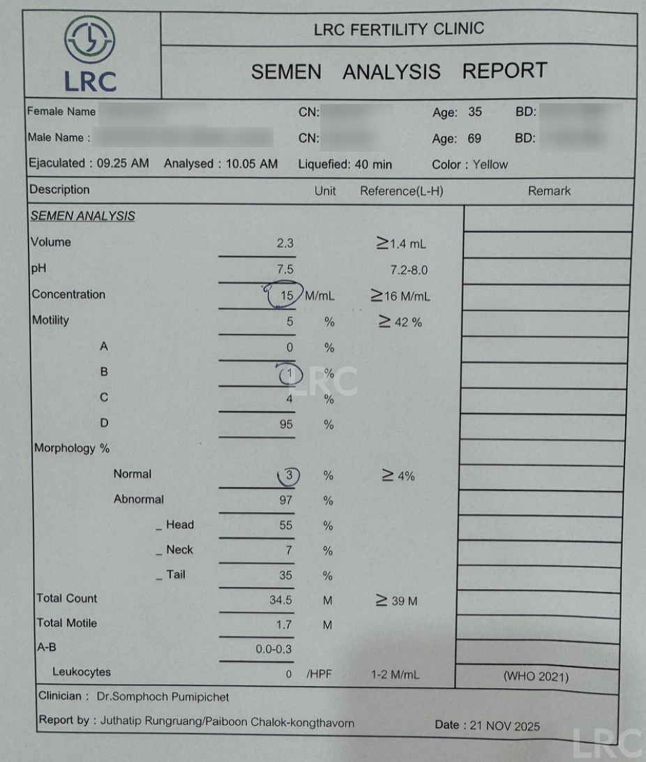 男方69岁重度弱精翻盘!LRC DGC高密梯度离心法+个性化促排方案,6周见胎心