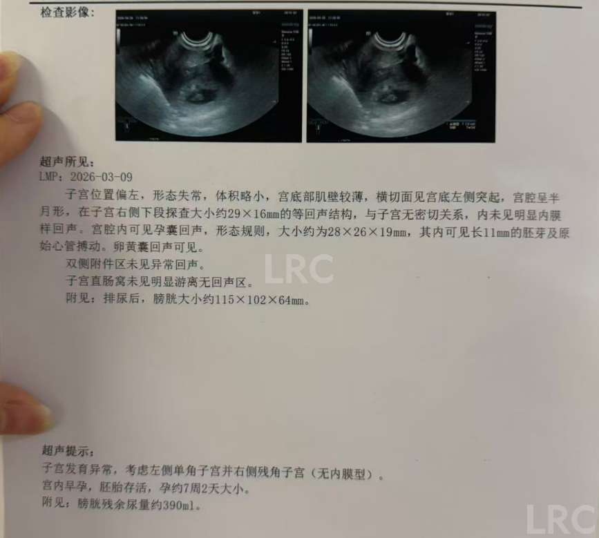 男方69岁重度弱精翻盘!LRC DGC高密梯度离心法+个性化促排方案,6周见胎心