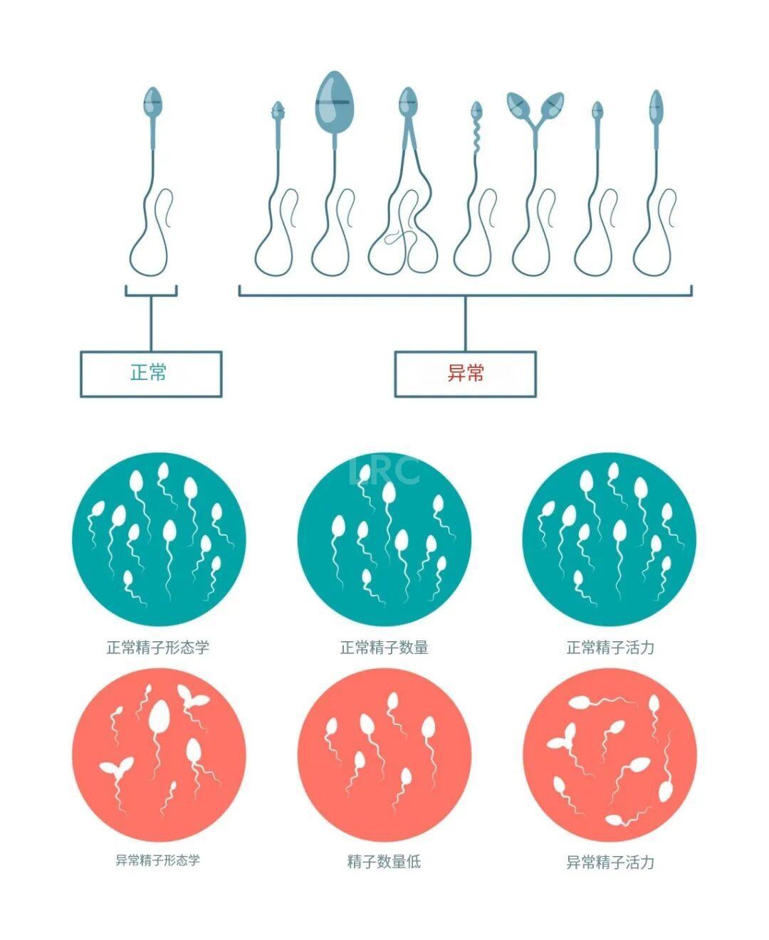 从受精到胚胎:精子质量到底影响有多大?