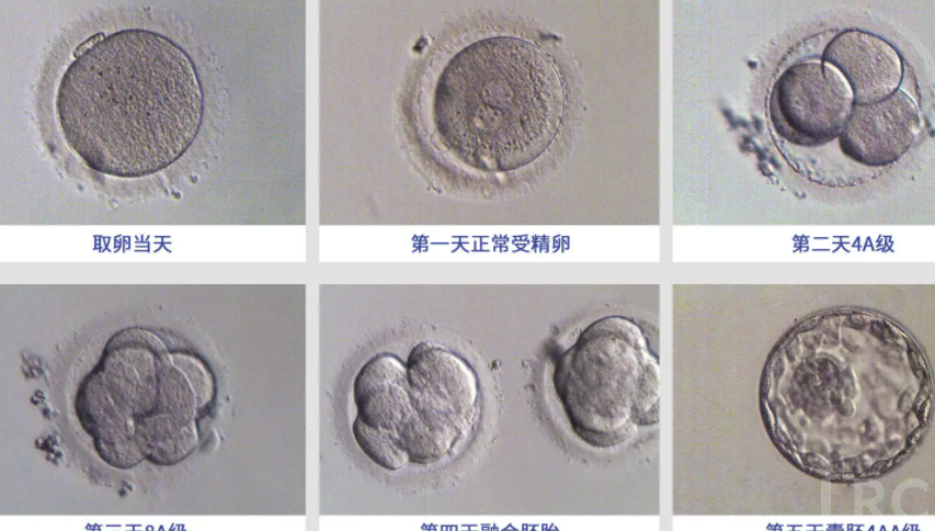 想知道泰国冻卵的真实价格吗？完整梳理试管婴儿冻卵成本构成！